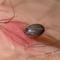 La maladie de Lyme